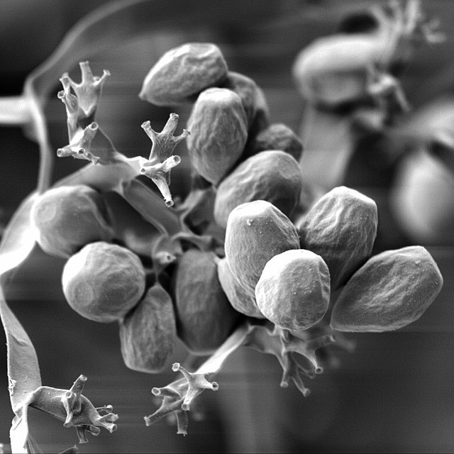 A Scanning electron microscope image in black and white. Small bulbous objects